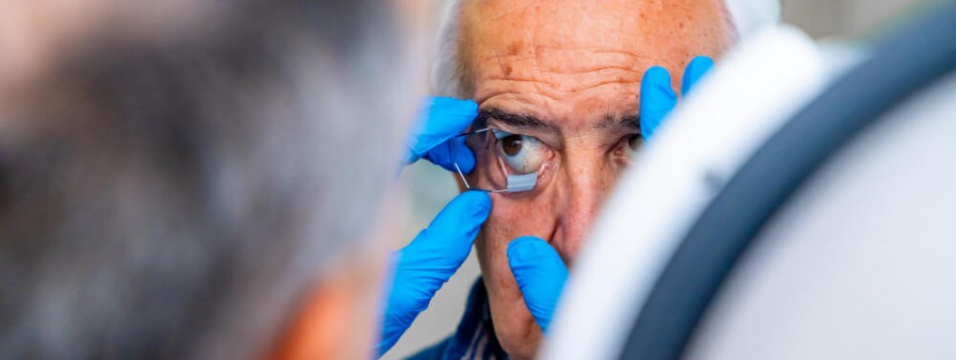 Maculopatia: forme, cause, sintomi e cure e il supporto dei nanobiopeptidi nella gestione di una malattia oculare che minaccia la visione